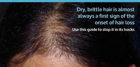 Dry Brittle Hair How To Prevent Hair Loss And Nourish The Hair