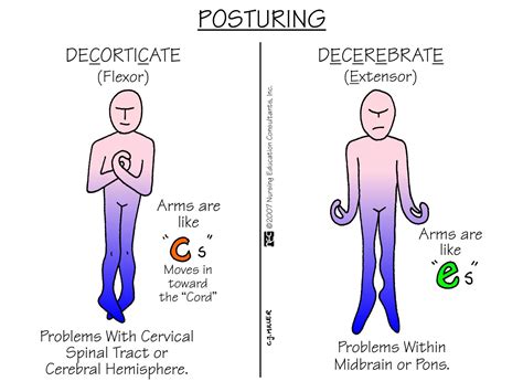 posturing decerebrate posturing  considered  worse