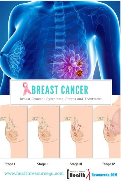 breast cancer causes symptoms stages detection