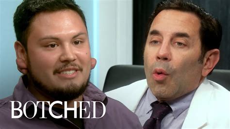 4 Botched Patients Shock Doctors Paul Nassif And Terry Dubrow E Youtube