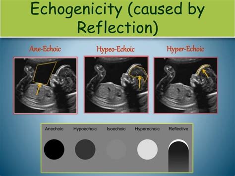 Applications Of Ultrasound In Medicine