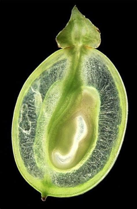 grapein  case  eat  seed pod microscopes microscopic photography micro
