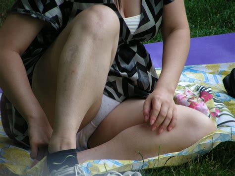 voyeur upskirt in park 3 very hq pictures exciting pictures high