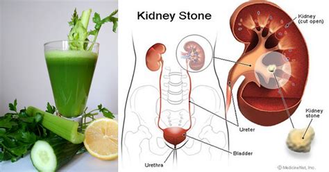 avoid   healthy kidney   juice recipe