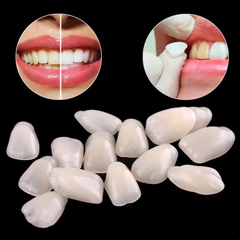 pcslot dental teeth veneers ultra thin whitening resin anterior