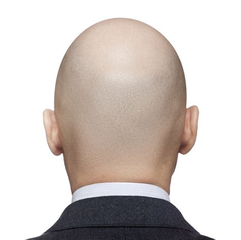 Bald Man Head Foundation For Biomedical Research