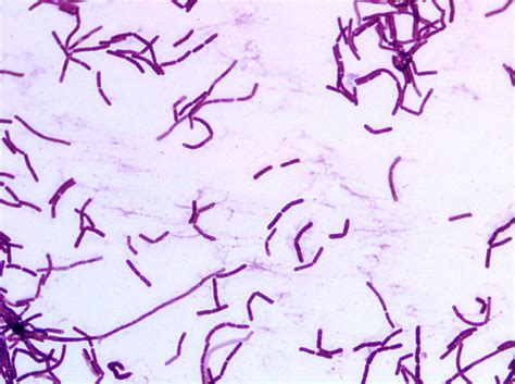 Bacillus Spp Morphology Visualised Using Gram Staining