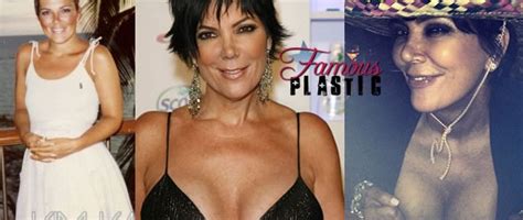Kris Jenner Plastic Surgery Before And After Photos Nose