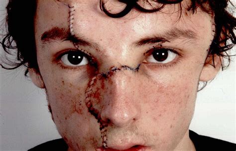 teenager who slashed best friend s face with a stanley knife in an attempt to blind him is