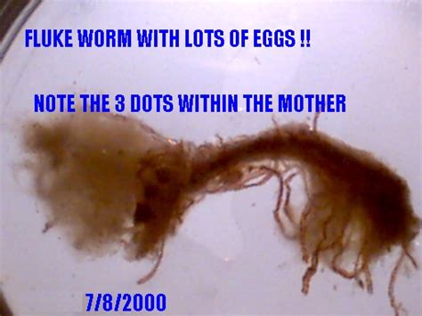 fluke worm  eggs  curezone image gallery
