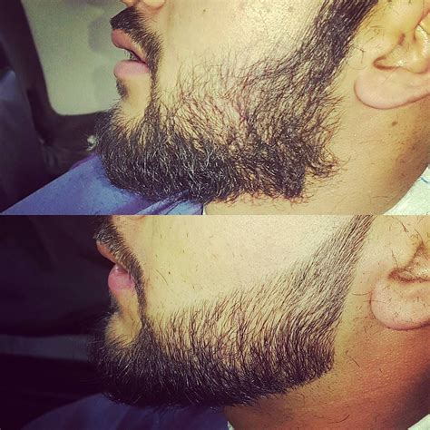 Beard Correction Trimnificent Before And After Look Elegance