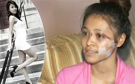 model attacked by two girls at a crowded mall her face slashed by