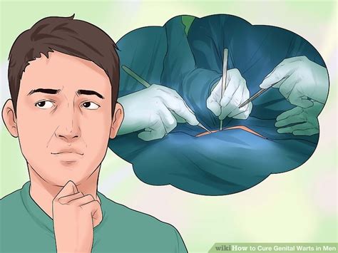 3 ways to cure genital warts in men wikihow