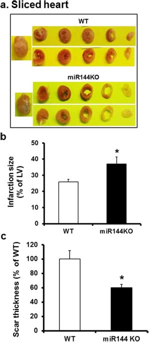 loss of mir 144 signaling interrupts extracellular matrix remodeling