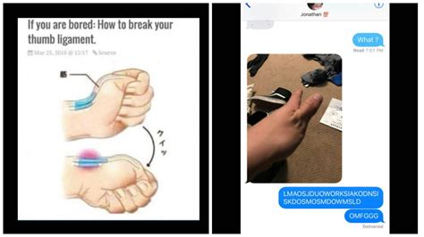 viral image shows teens how to break their own thumbs