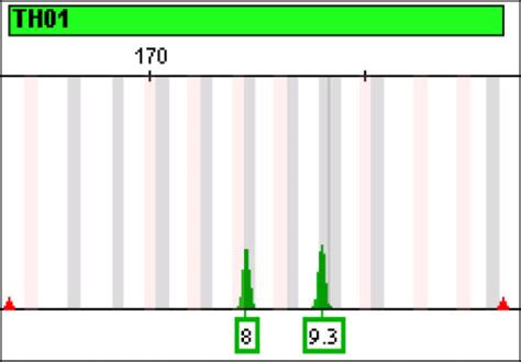 2 An Electropherogram Indicating The Genotyping Result For One Sample