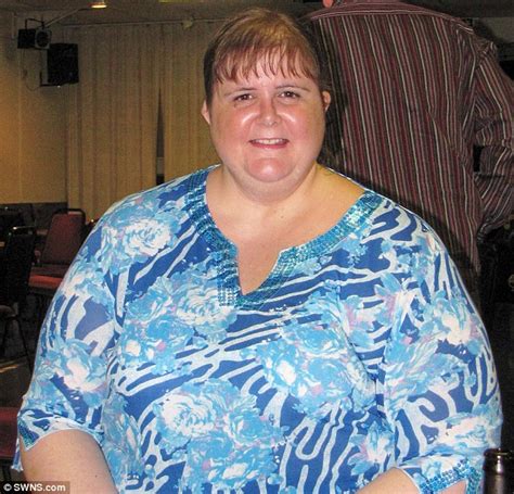 Super Slimmer Loses 13st In Just A Year After Lift Breaks At Work