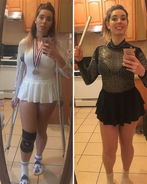 Was On Crutches Last Halloween And Went As Nancy Kerrigan This Year