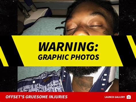 offset posts several gnarly photos of his car crash injuries