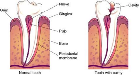cavity   doesnt  hurt wake dental wellness dentist  wake forest
