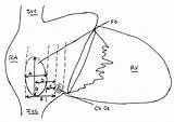 Patents sketch template