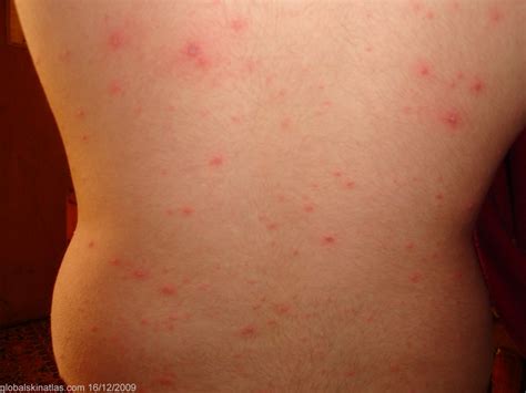 diagnosis skin rash diagnosis pictures