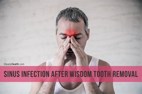 sinus infection  wisdom tooth removal ear nose throat