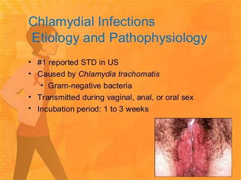 sexually transmitted infections and hiv class 2015