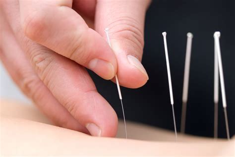 acupuncture  acupuncture work  science
