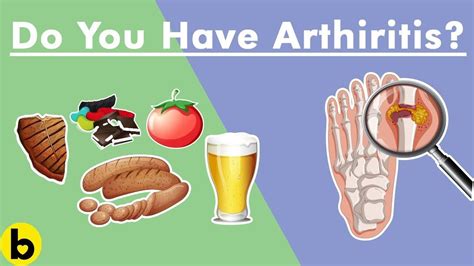 foods harmful  arthritis png food   world favorite
