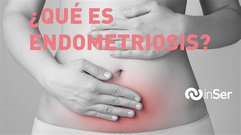 endometriosis causas síntomas y tratamiento youtube