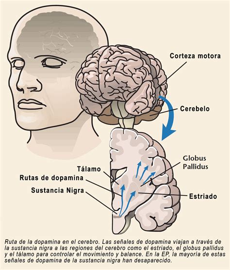 la complejidad del parkinson  las enfermedades neurodegenerativas