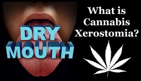Why Do You Get Cotton Mouth From Cannabis