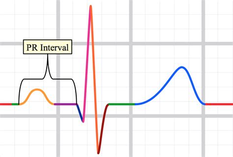 teaching medicine tutorial analyze  waveforms