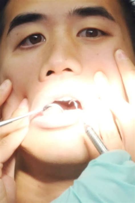man uses dental instruments to play cover of i can t feel my face
