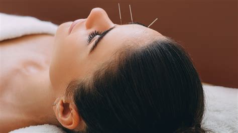 what you should know about acupuncture