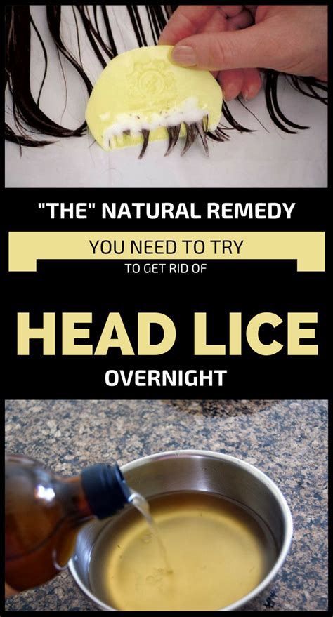 the natural remedy to get rid of head lice overnight