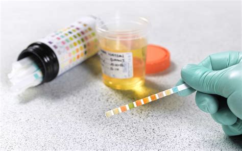 drug testing    pass  drug test high times