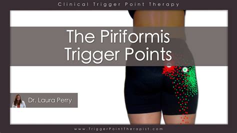 The Piriformis Trigger Points Youtube
