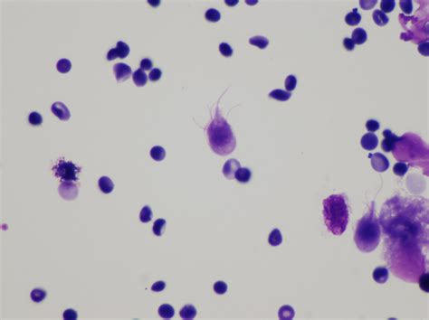 file giardia lamblia cytology wikipedia