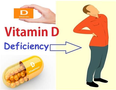 Vitamin D Deficiency Symptoms Causes Health Risk And Prevention