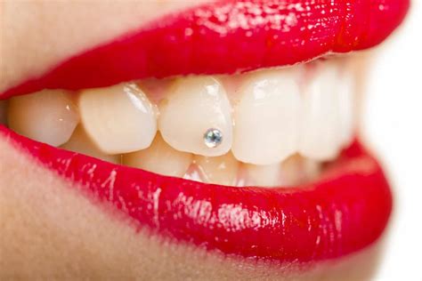 cost  put  diamond   teeth dental care report