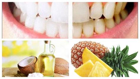 memutihkan gigi secara alami konsumsi buah hingga gunakan