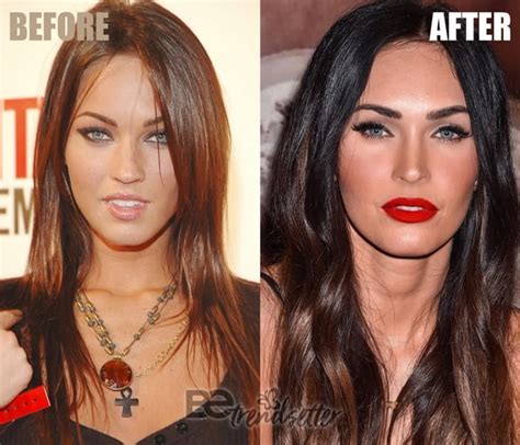 Megan Fox Plastic Surgery Before And After Revealed 2018