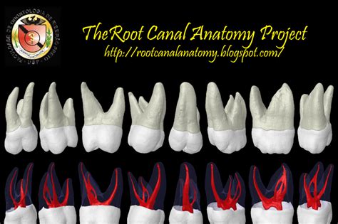 root canal anatomy project maxillary  molar