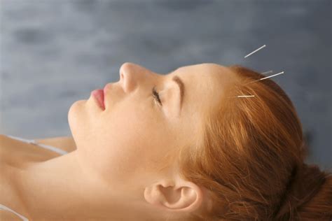 acupuncture actigraph sleep discovery