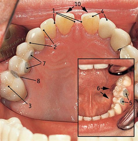 les differentes faces de la dent
