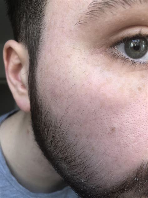 how can i turn peach fuzz into a beard r beardtalk