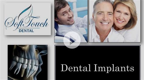 dental implants san diego soft touch dental