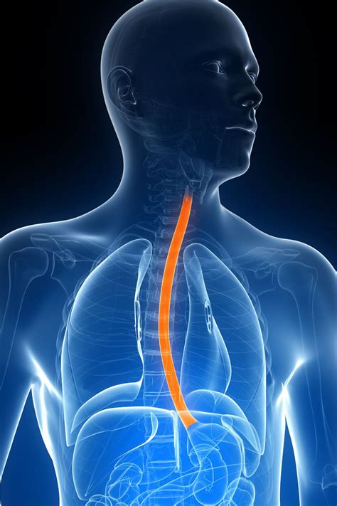 esophageal cancer overview